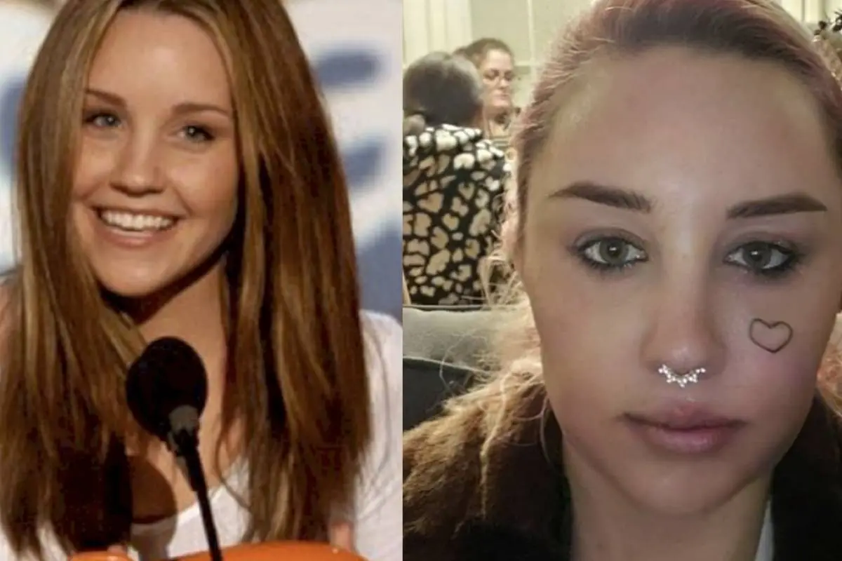 Amanda Bynes antes y ahoras, 