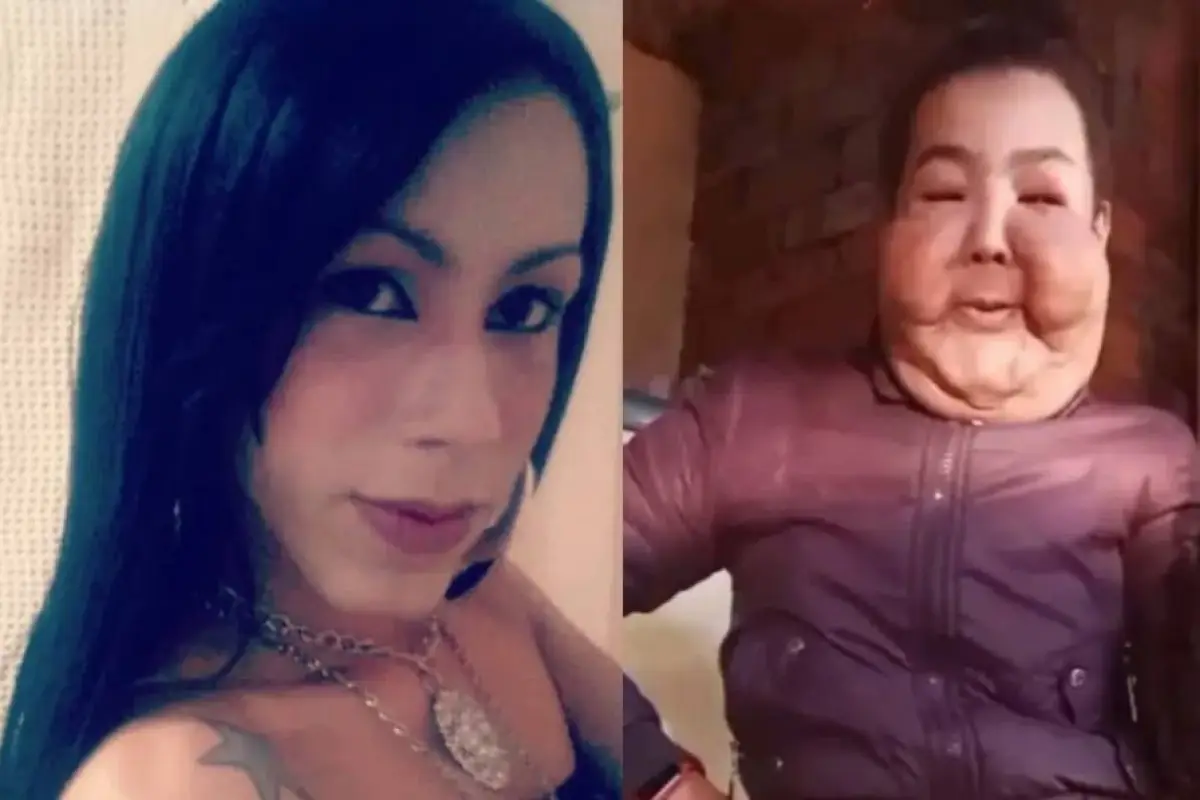 El antes y el después de Juliana Olivares., Redes sociales.